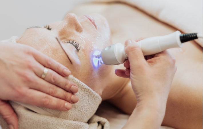 A woman receiving laser treatment on her skin for her acne scarring