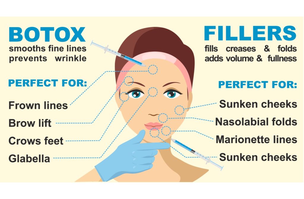 A comparison between botox and fillers, with an illustration of a woman's face in the middle and lines pointing to different parts of her face, listing what both botox and fillers are perfect for