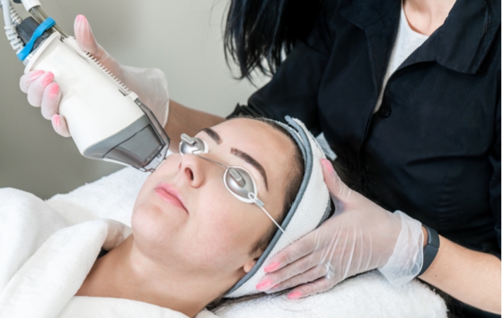 A woman getting a skin resurfacing procedure performed on her face to remove the uneven textured skin on her face