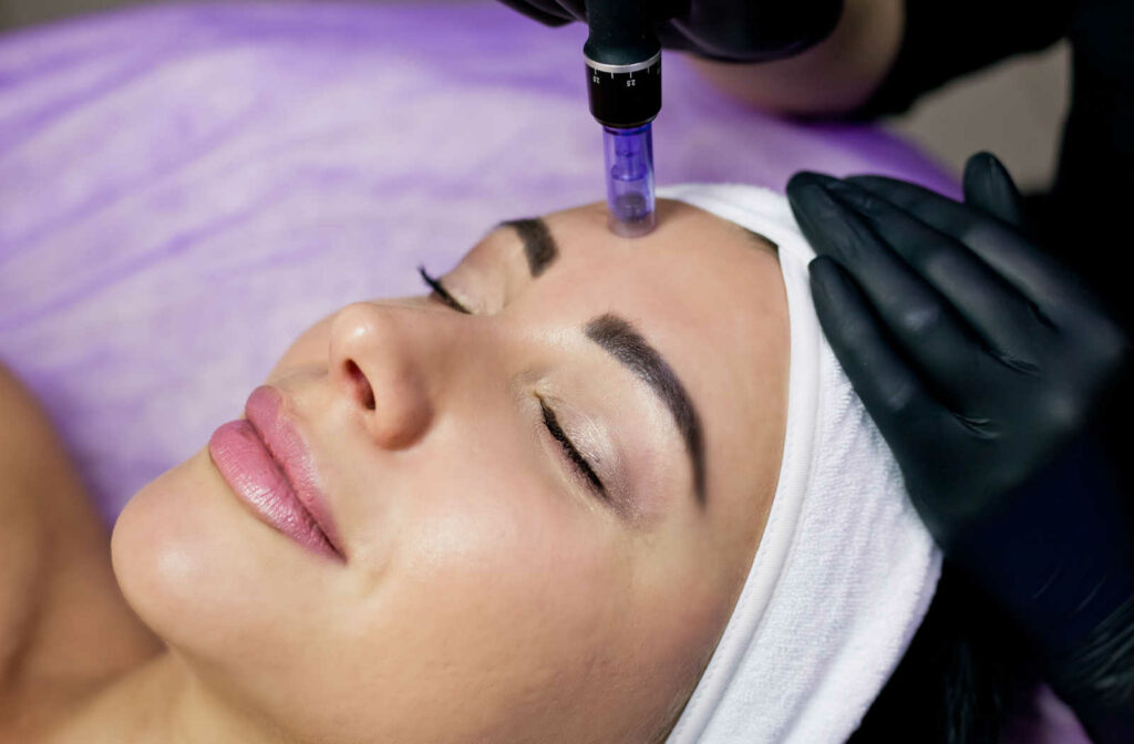 A woman with her eyes closed receiving a microneedling treatment from a medial aesthetician