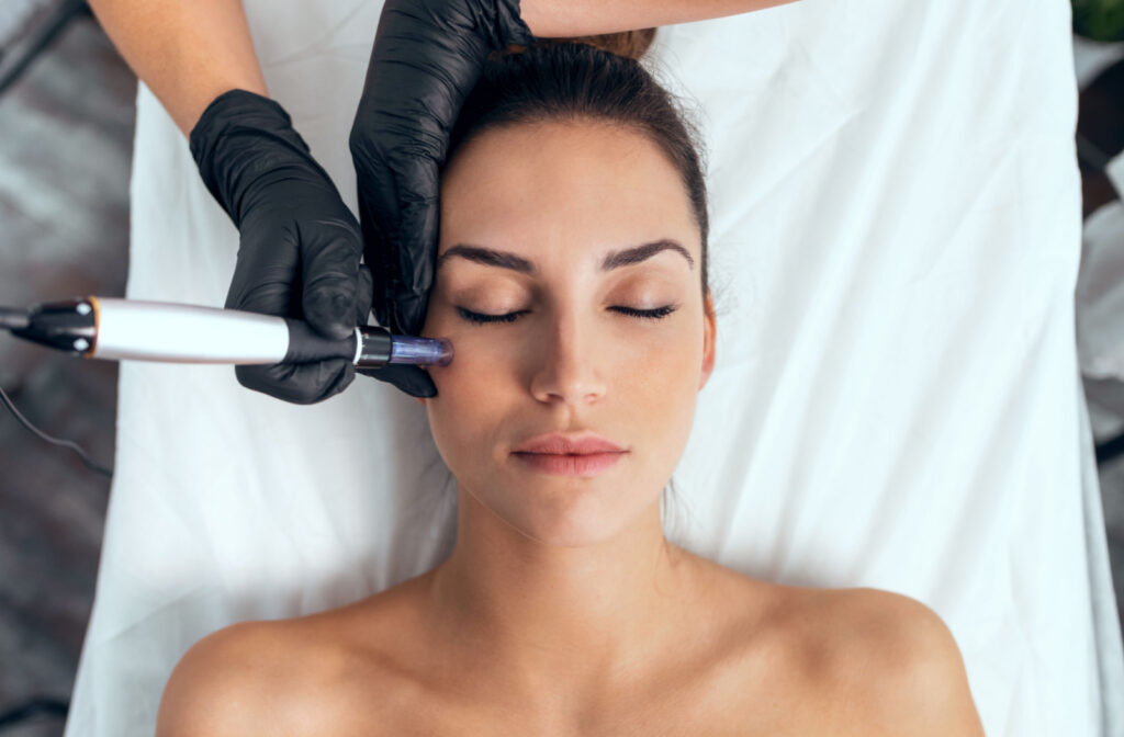 A woman receiving a microneedling treatment for acne scars from a licensed aesthetician.