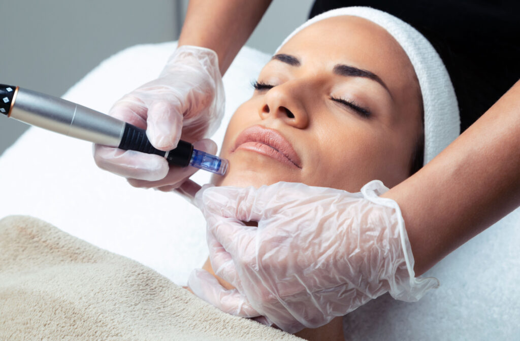 A woman receiving a microneedling treatment from an aesthetician.