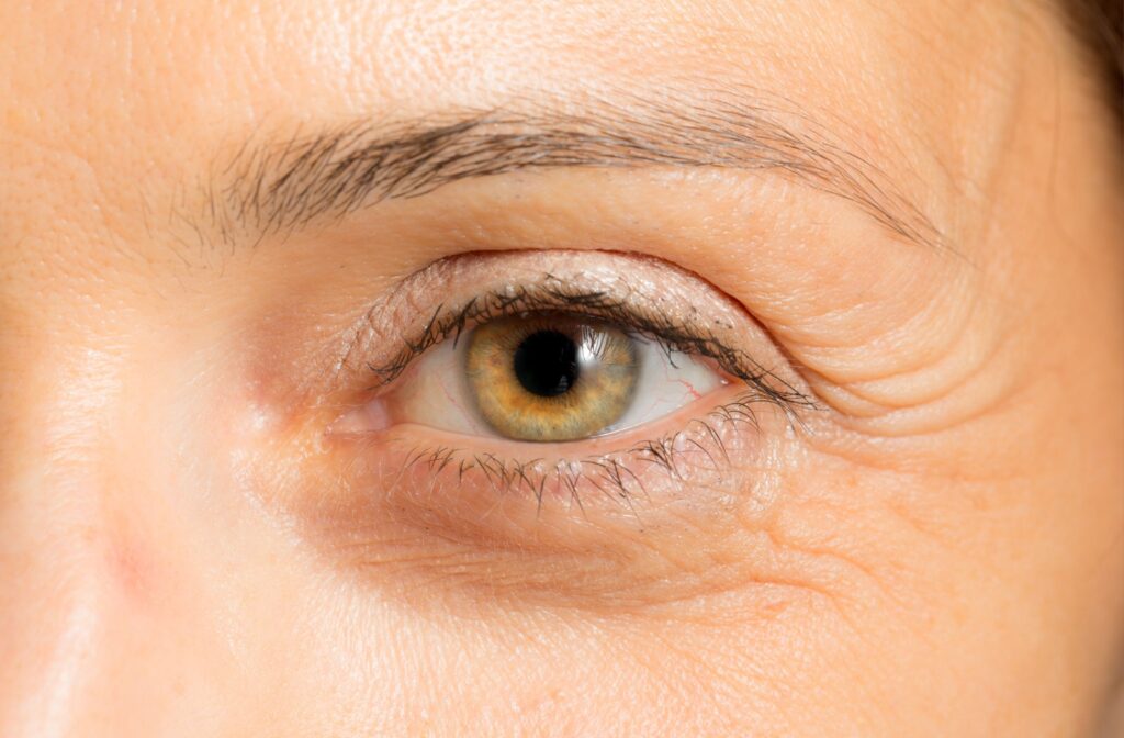A close up of someones eye with crow's feet wrinkles near their eye